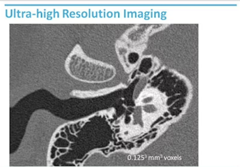 Innovations in Ultra-High-Resolution Imaging - Society for Brain ...